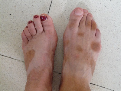 pied